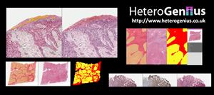 HeteroGenius Limited, as part of the Northern Pathology Imaging Co-operative, receives £10m government investment for AI and digital pathology