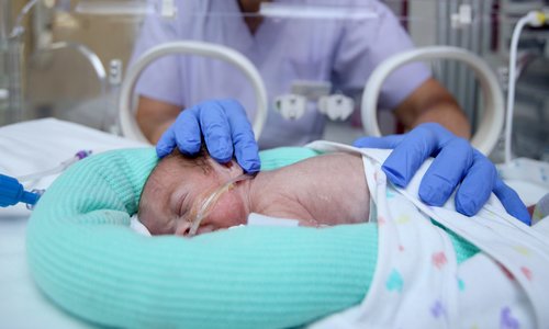 Early education setback for summer premature births
